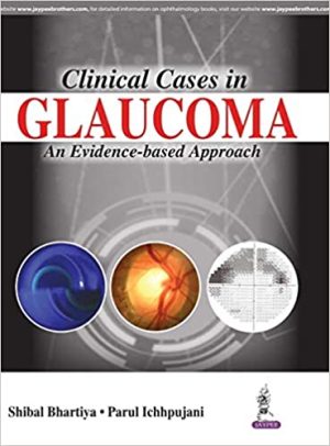 Clinical Cases in Glaucoma An Evidence Based Approach
