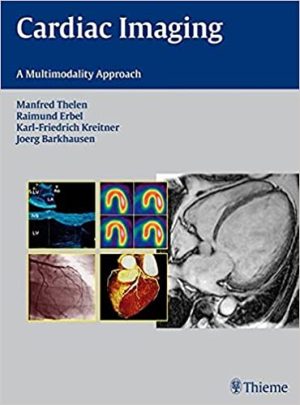 Cardiac Imaging A Multimodality Approach