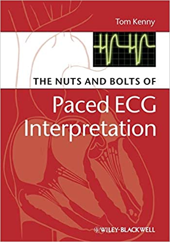 The Nuts and bolts of Paced ECG Interpretation