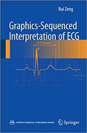 Graphics Sequenced interpretation of ECG