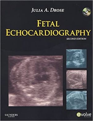 Fetal Echocardiography 2nd Edition By Julia A Drose