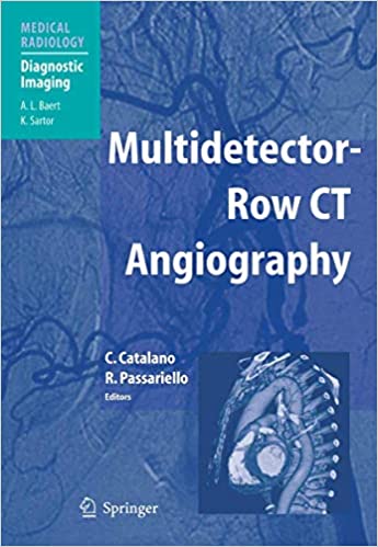 Multidetector Row CT Angiography