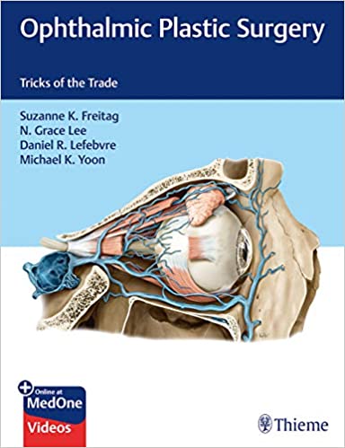 Ophthalmic Plastic Surgery Tricks of the Trade