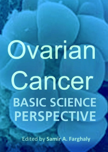 Ovarian Cancer Basic Science Perspective