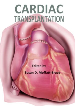 Cardiac Transplantation